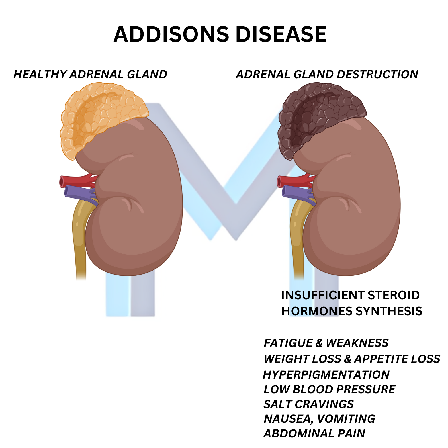 Addison Disease (Primary Adrenal Insufficiency)