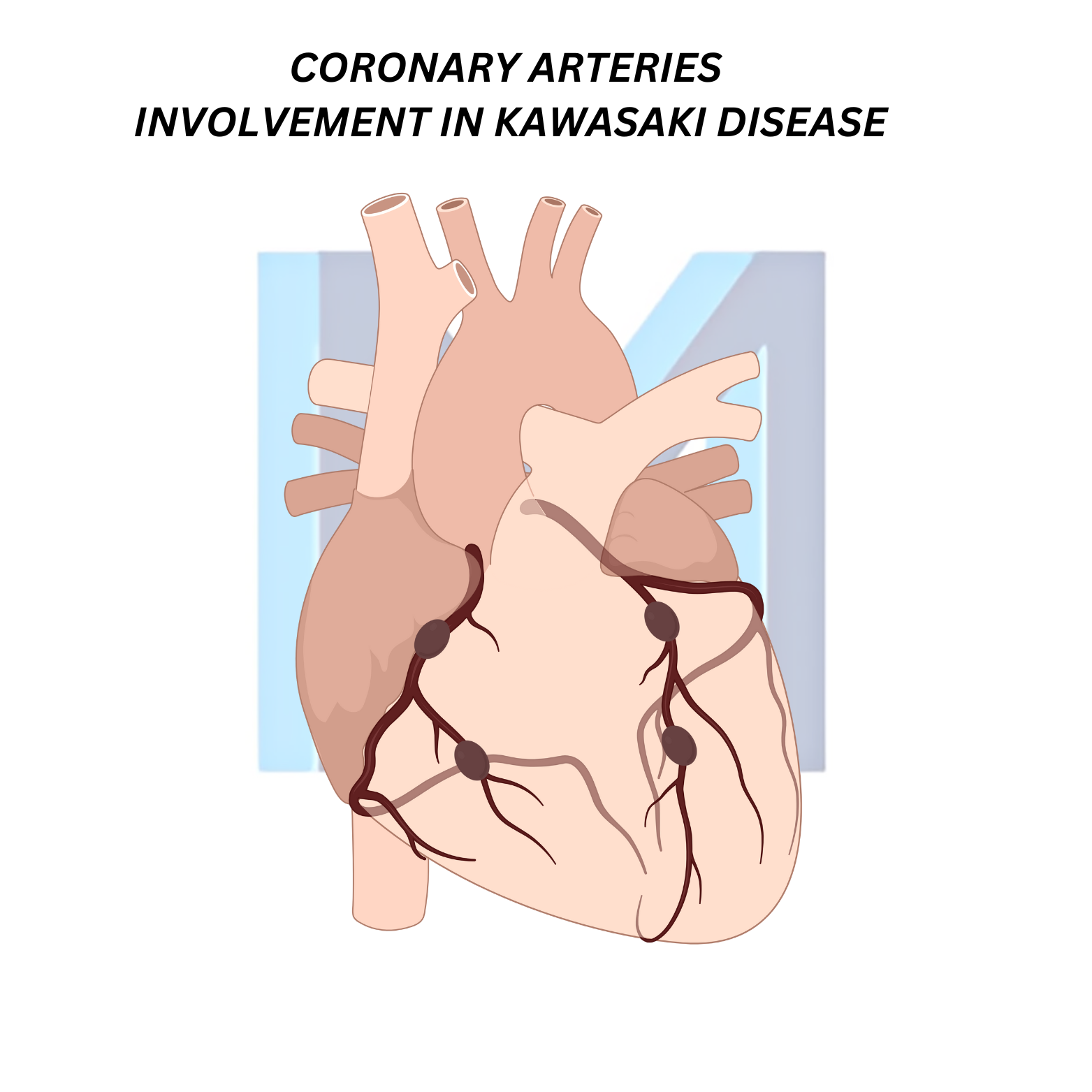 Kawasaki Disease