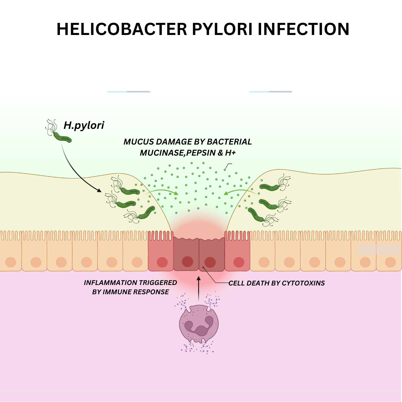 Helicobacter pylori Infection