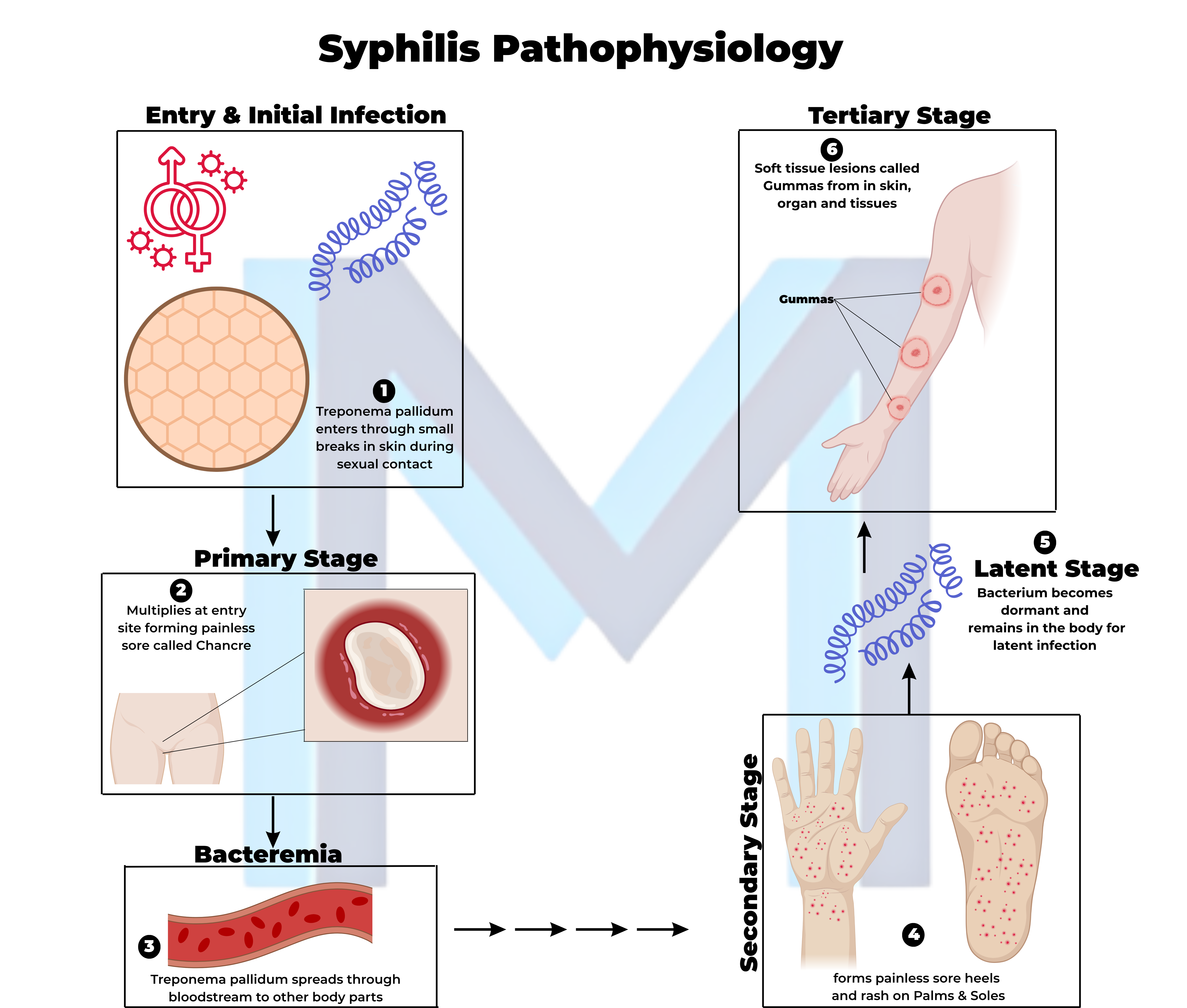 Syphilis