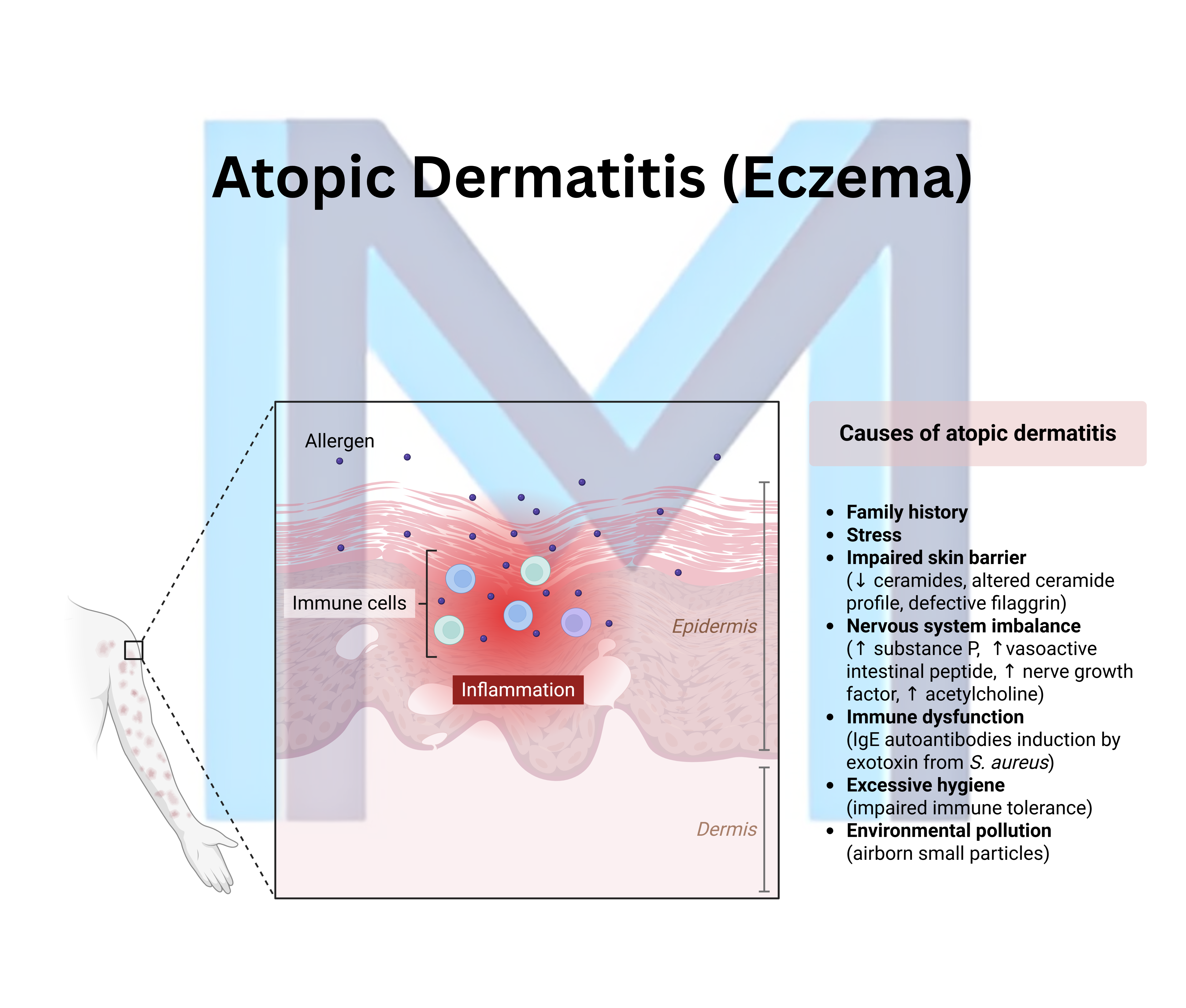 Atopic Dermatitis (Eczema)
