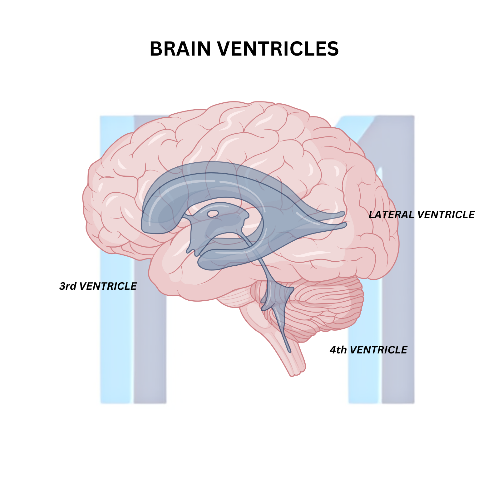 Subarachnoid Hemorrhage